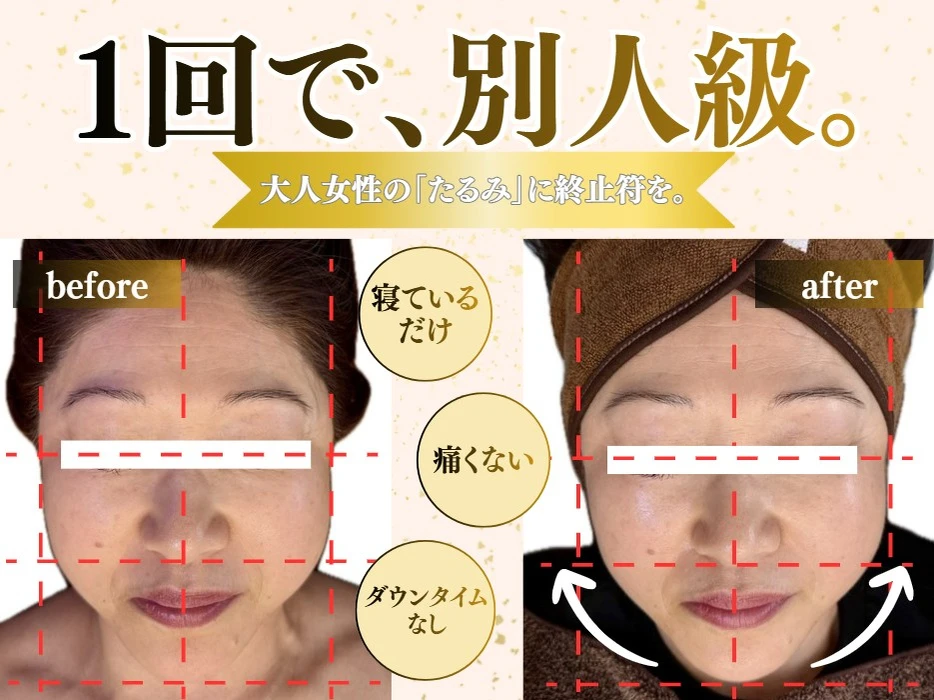画像415